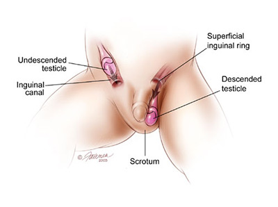 Red bump on scrotum